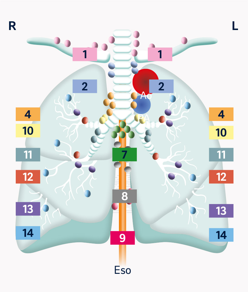 TNM lungcancer - Koronar vy över ventral