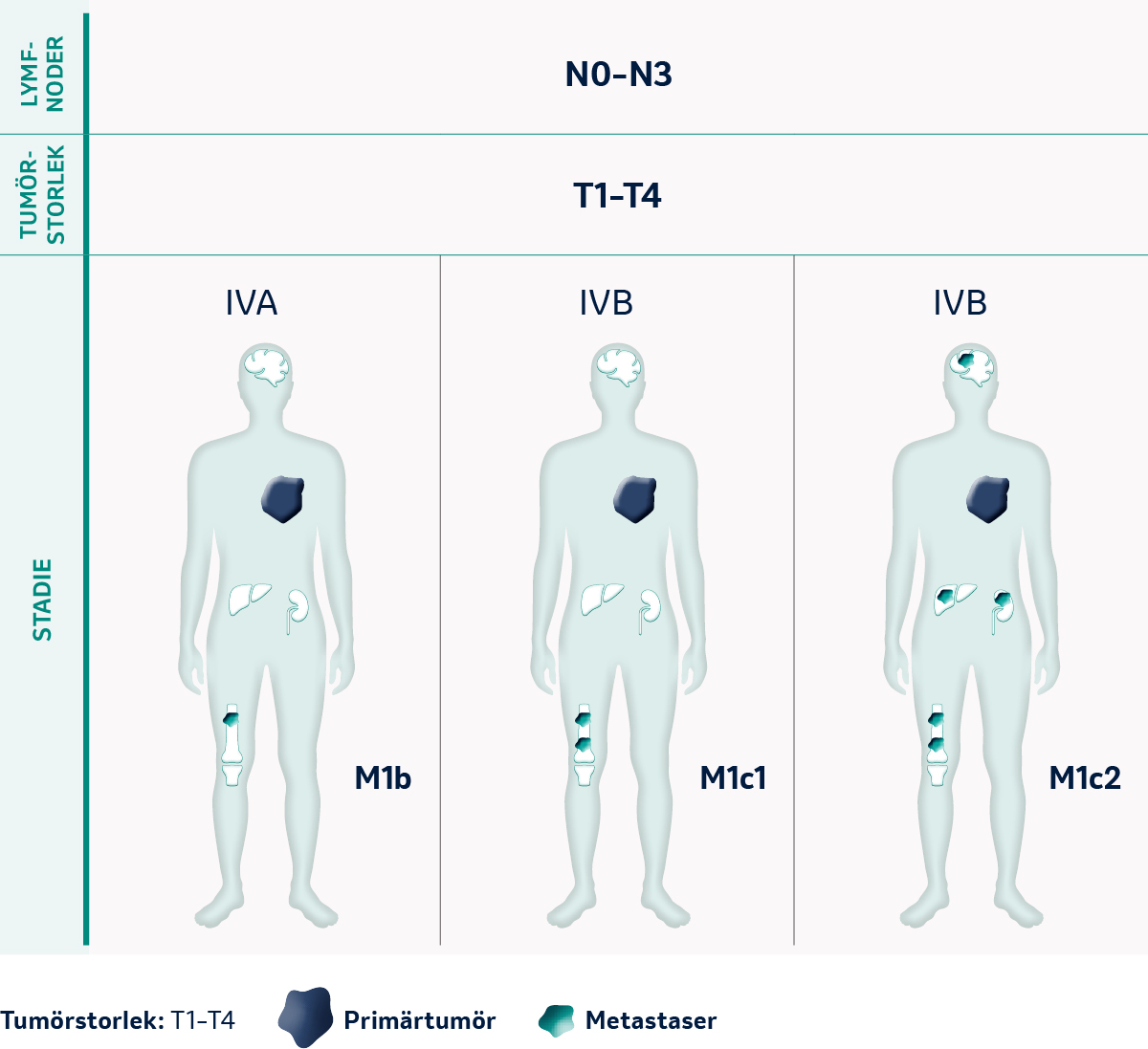 TNM Tumörstadier i M-klassifikationerna